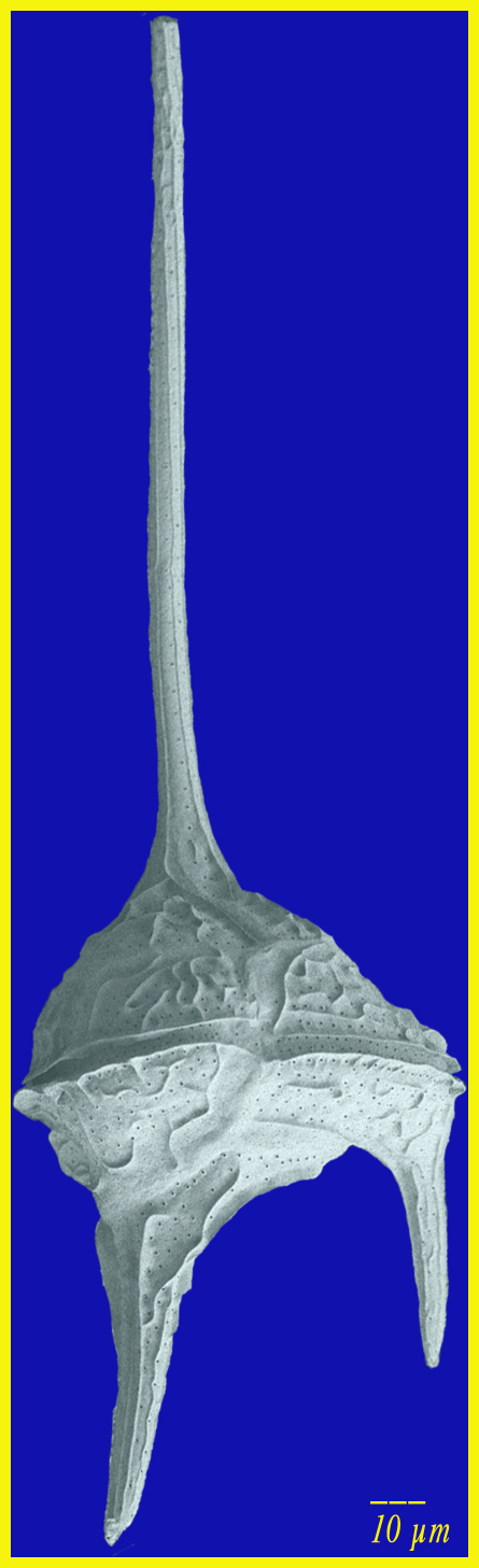 Ceratium candelabrum SEM image