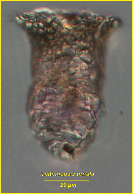 Tintinnopsis urnula