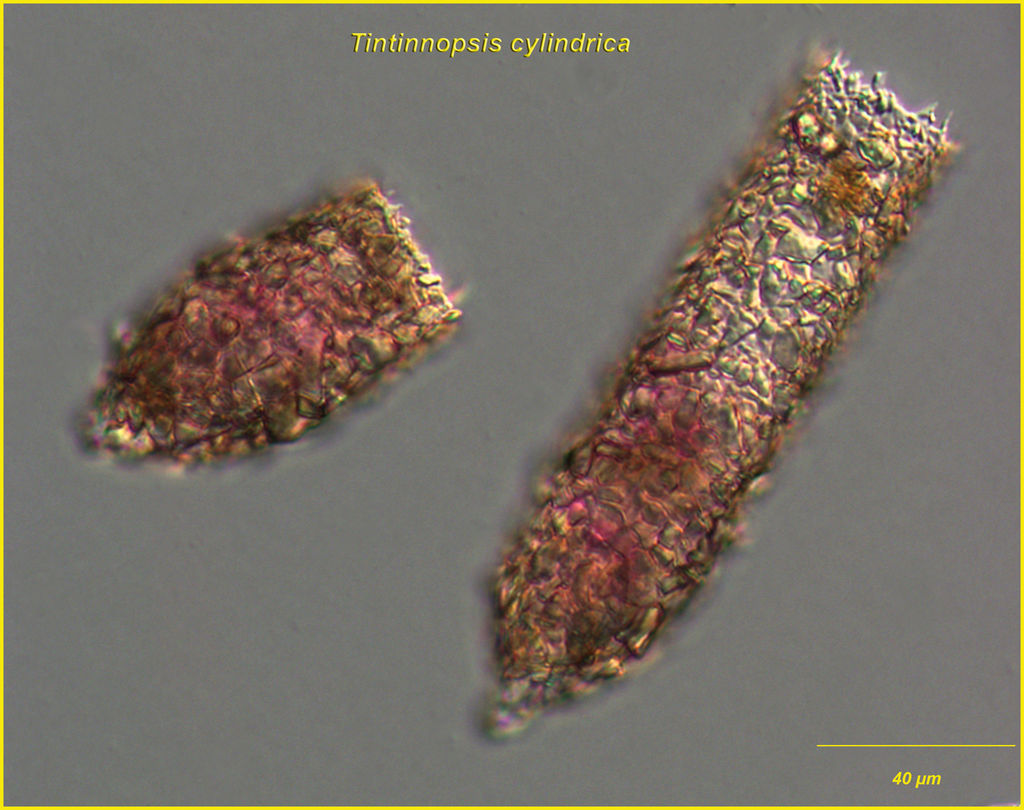 Variability in Tintinnopsis cylindrica