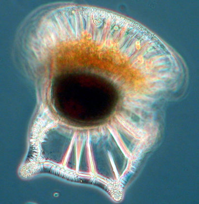 Ornithocercus magnificus - a heterotrotrophic dinoflagellate