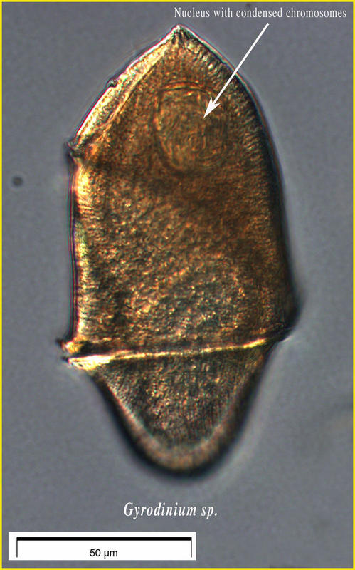A heterotrophic dinoflagellate: Gyrodinium
