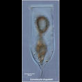 Cymatocylis drygalskii