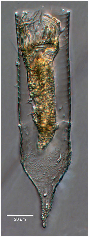 Codonellopsis gaussi morph?