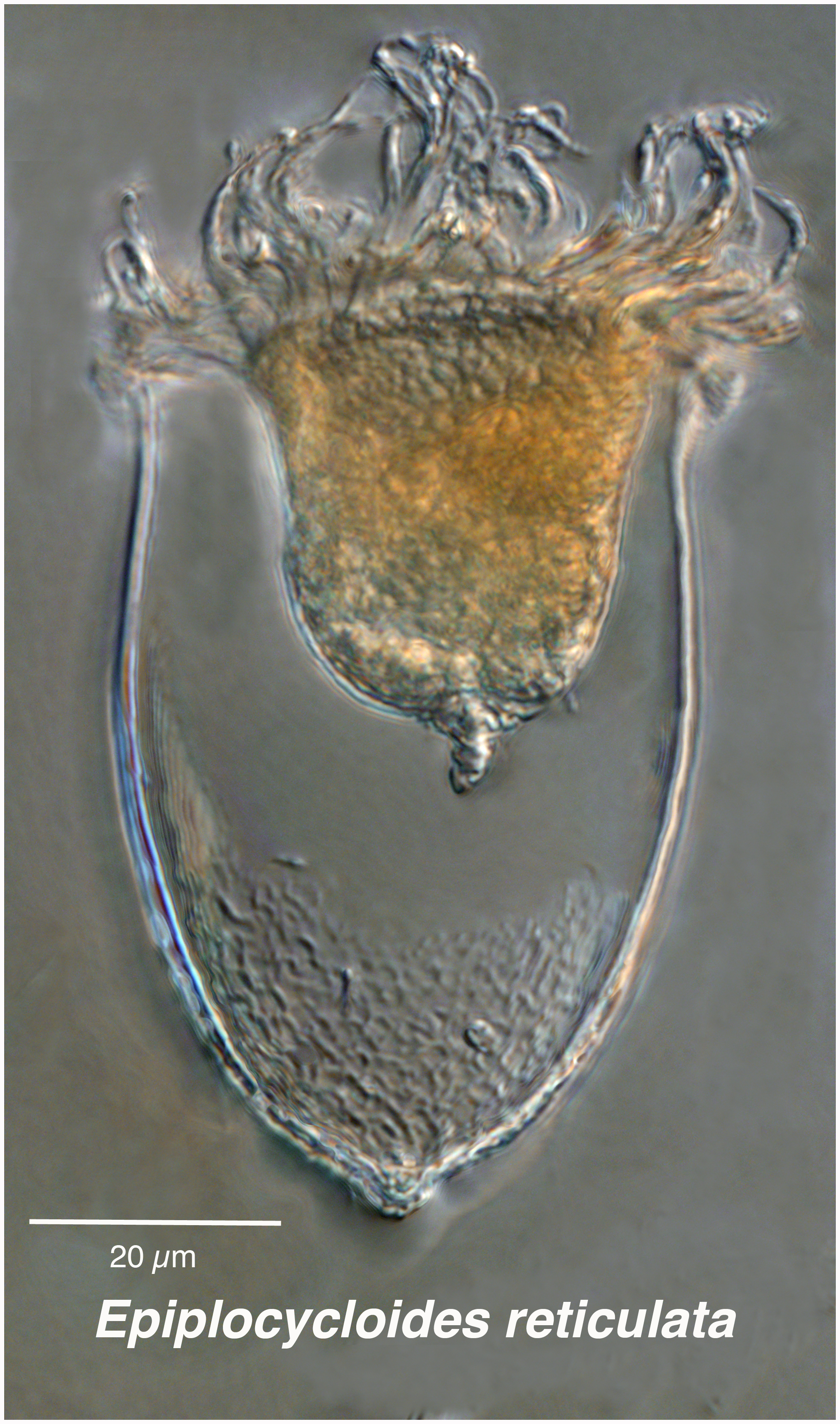 Epiplocyloides reticulata