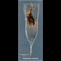 Cymatocylis cylindrica