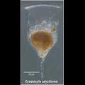 Cymatocylis calyciformis