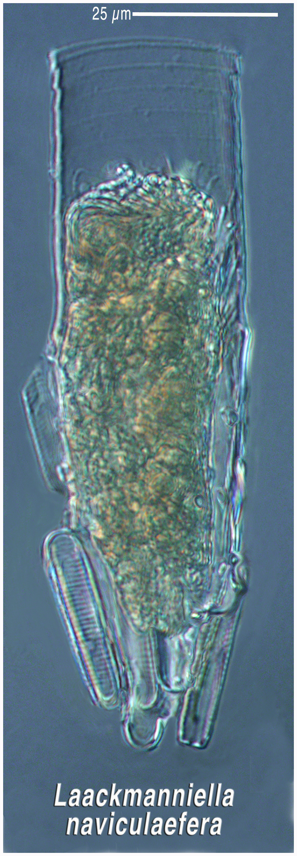 Laackmanniella naviculaefera