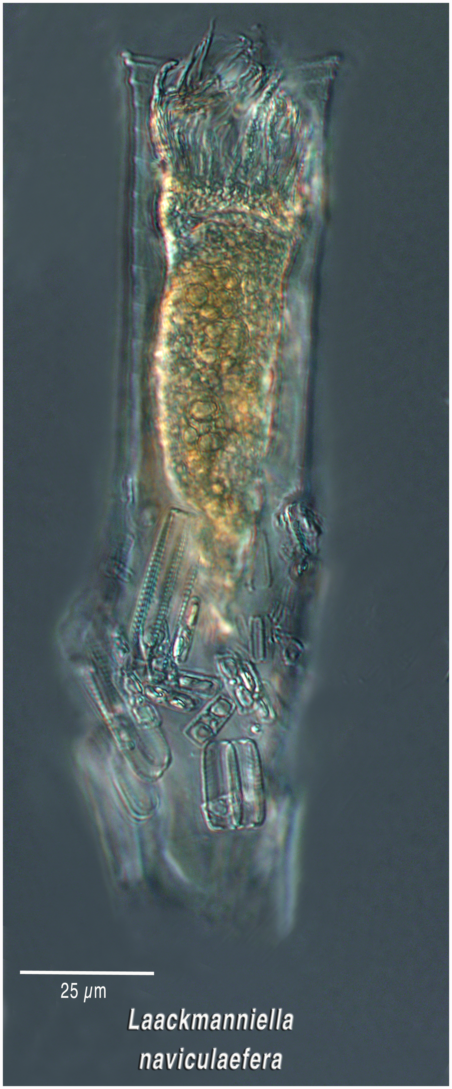 Laackmanniella naviculaefera (diatom collector)