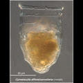 Cymatocylis affinis morphotype