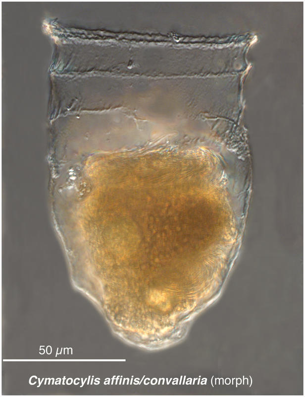 Cymatocylis affinis morph