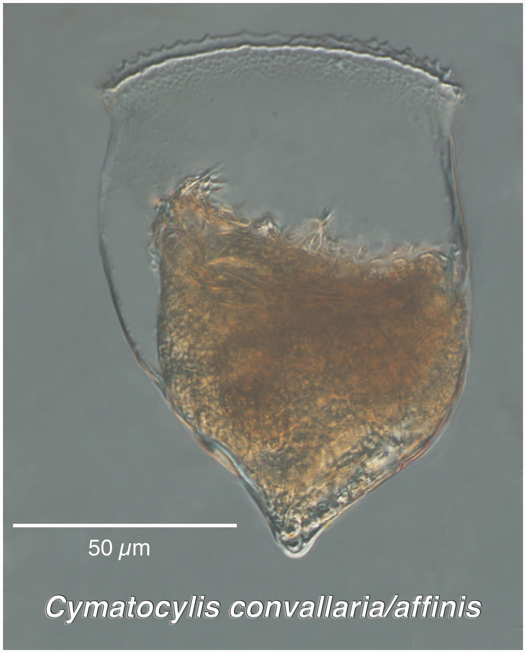 Cymatocylis convallaria/afinis