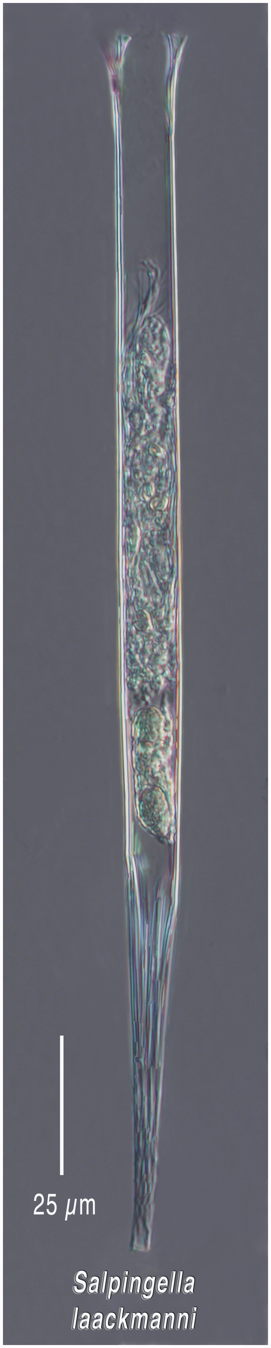 Salpingella laackmanni from the Amundsen Sea Antarctica