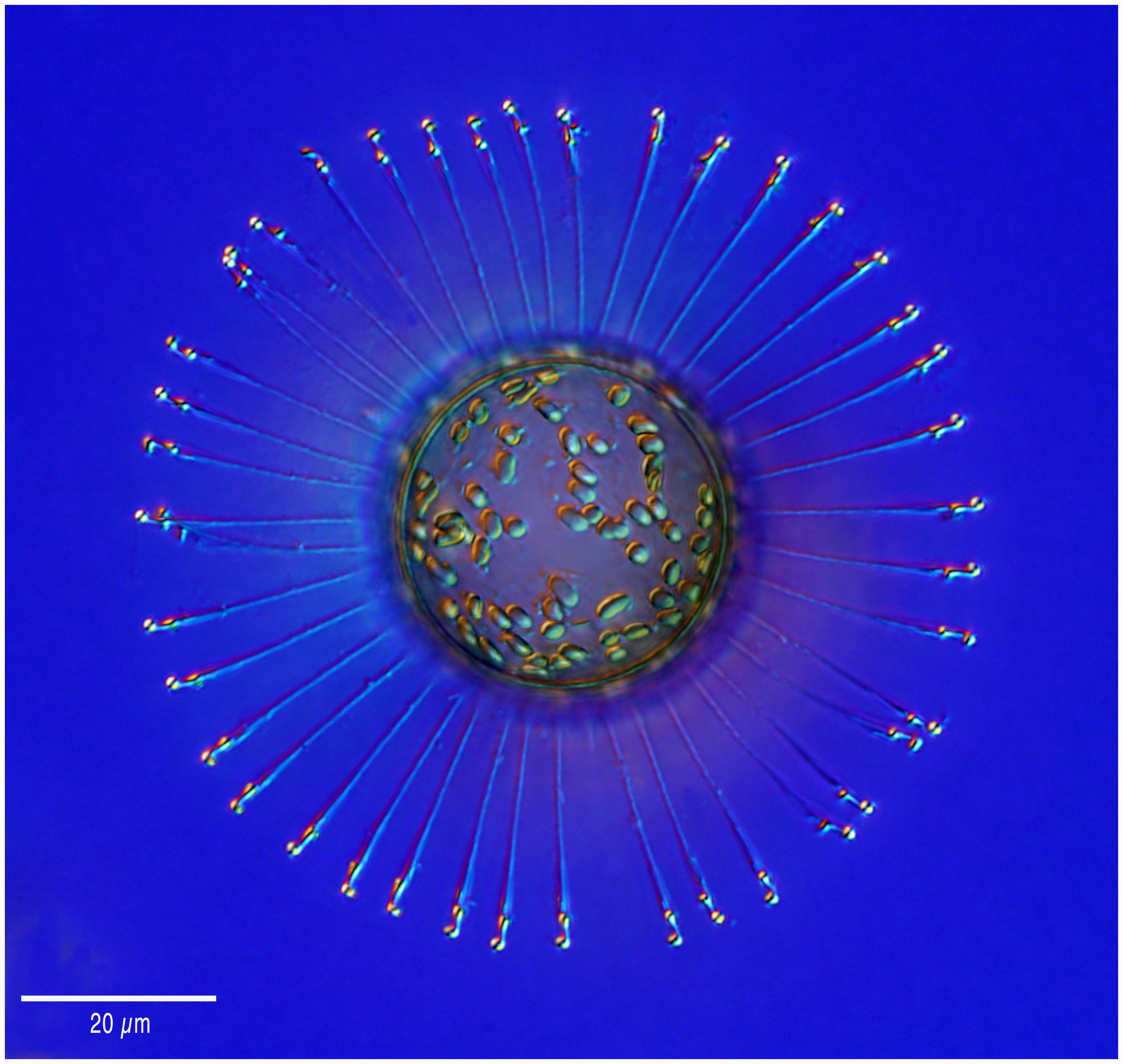 Antarctic Diatom Corethron