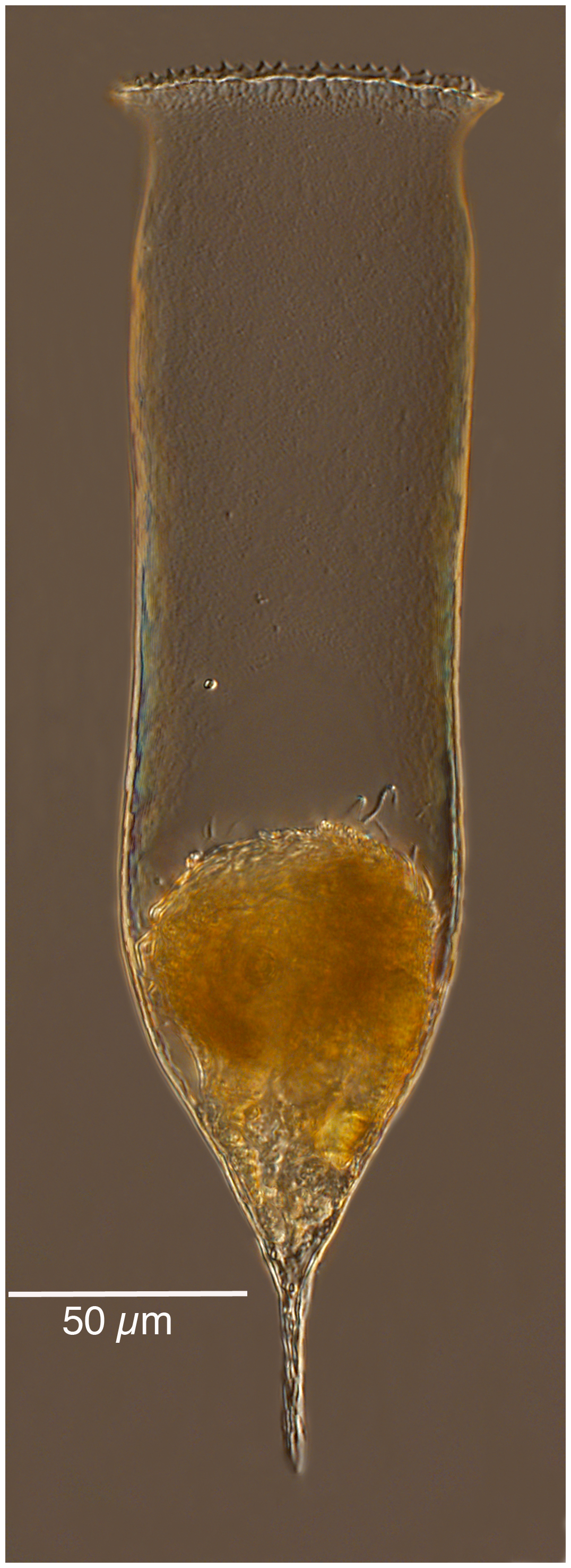 Cymatocylis cylindrica