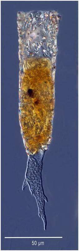 Rhizodomus tagatzi or Tintinnopsis corniger