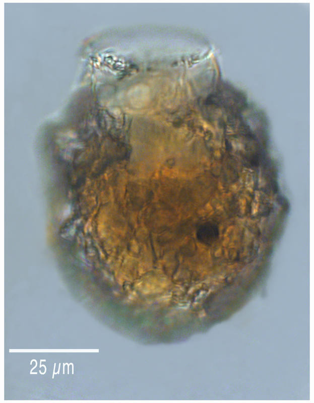 Stenosomella ventricosa collar variant