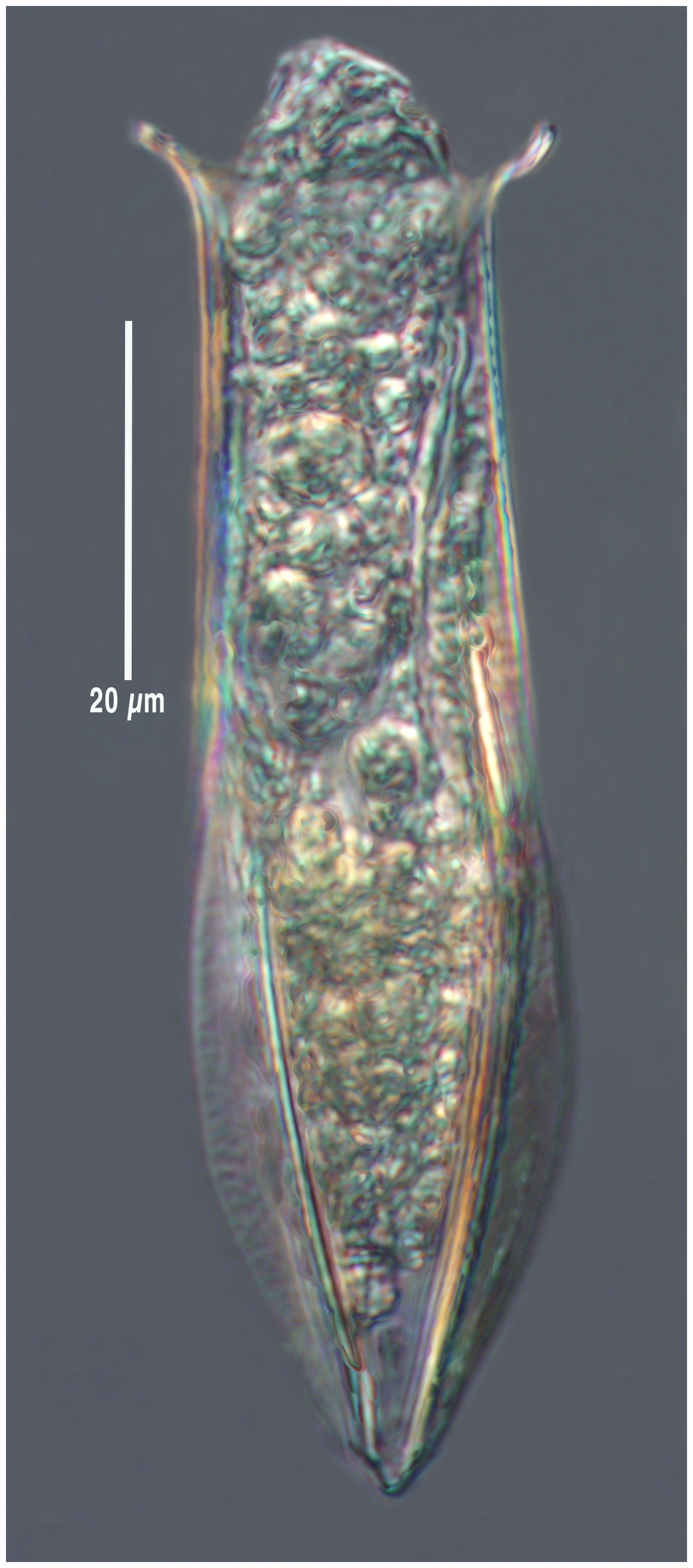 Amphorellopsis laevis Kofoid & Campbell 1929