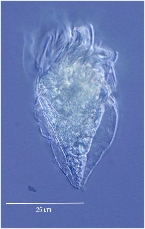 Coxiella-form perhapsa Laackmanniella or Codonellopsis forming a new lorica