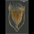 Cymatocylis affinis/convallaria