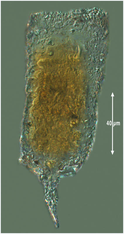 Tintinnopsis lindeni