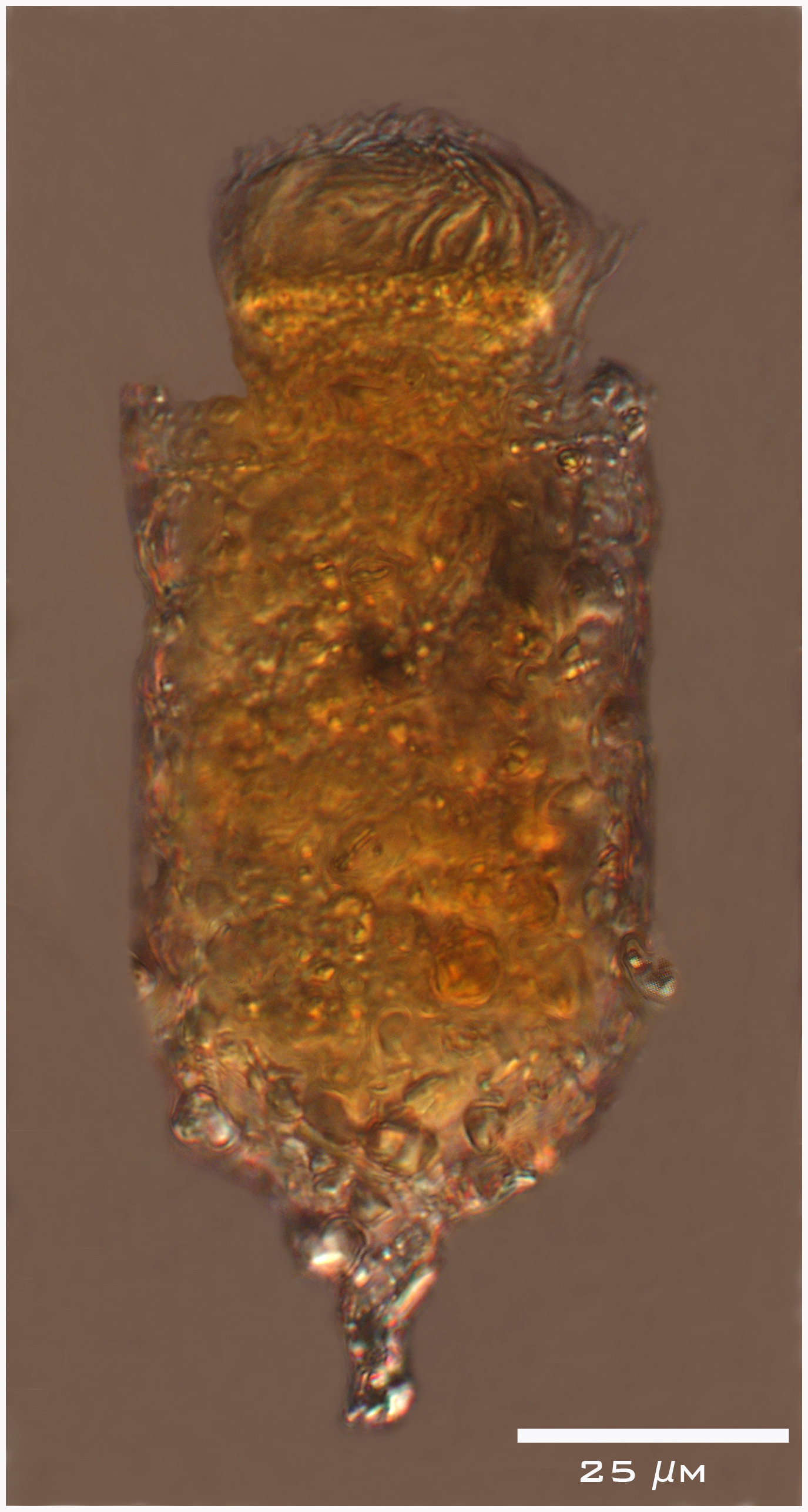 Tintinnopsis lindeni