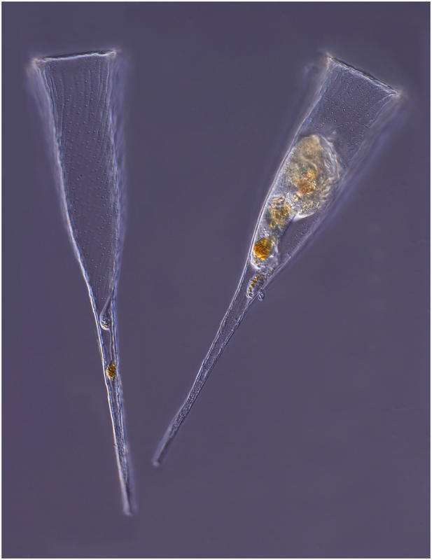 Rhabdonella spiralis- lorica and live specimen