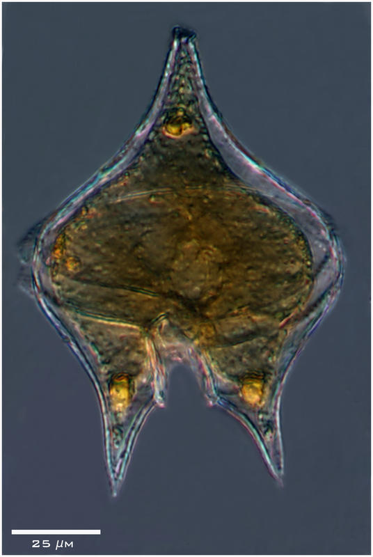 Protoperidinium oblongum