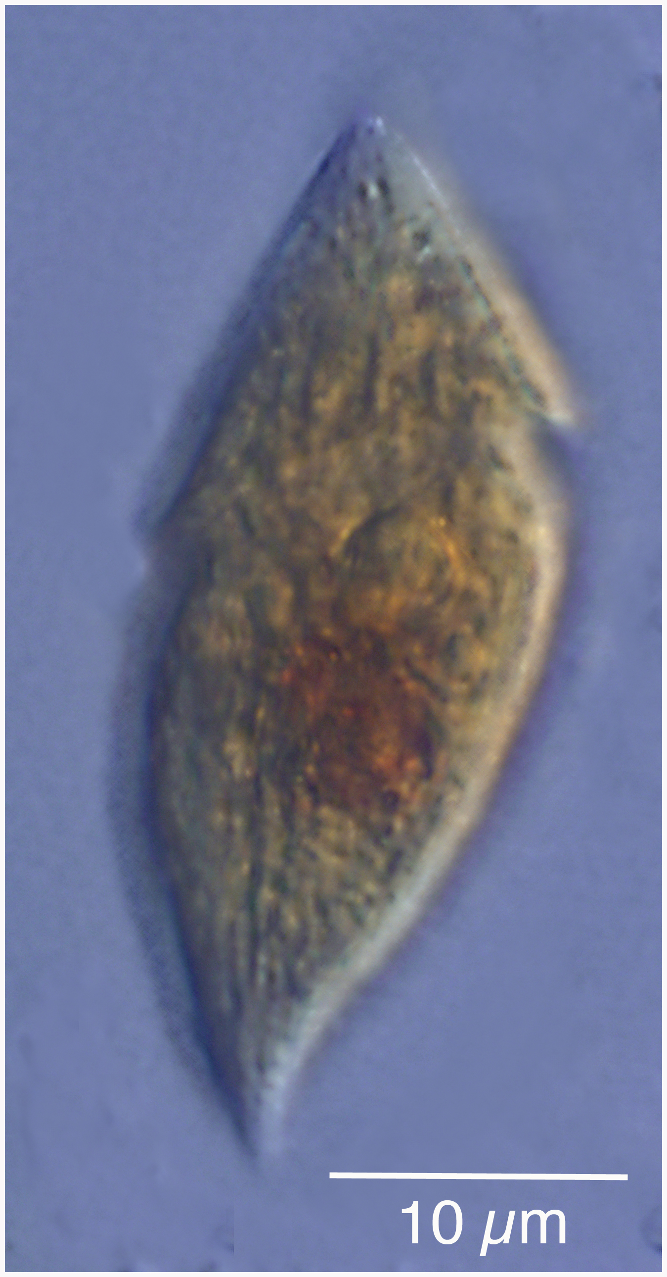 small Gyrodinium from the Etang de Thau