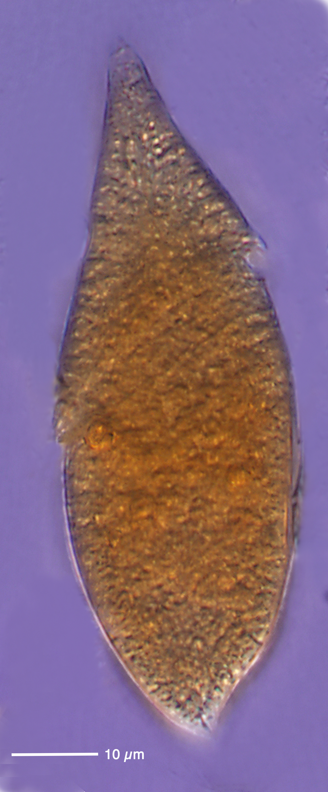 large Gyrodinium species from the Etang de Thau