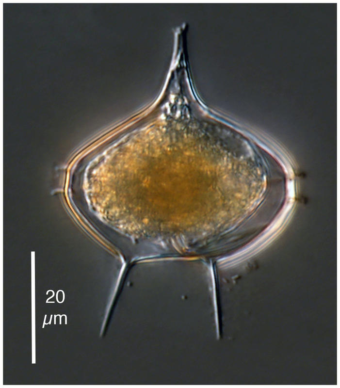 Protoperidinium cf. elegantissimum