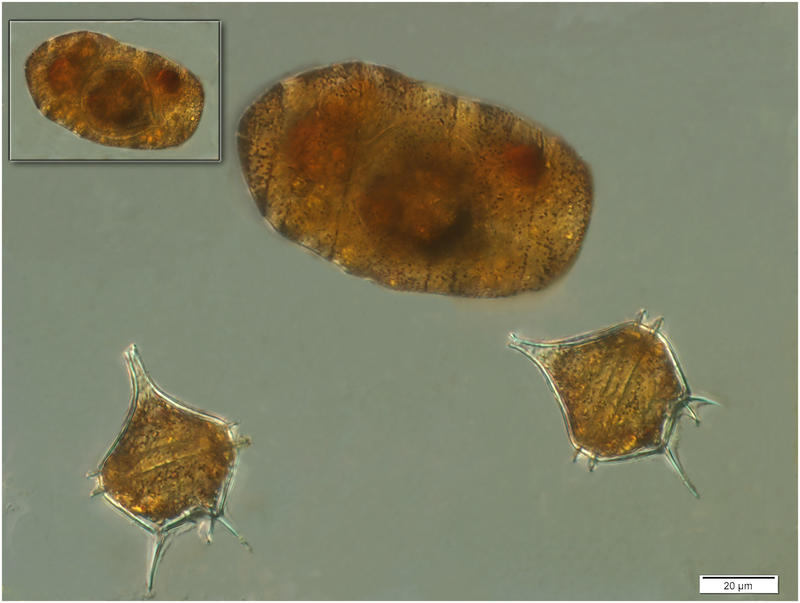 Polykrikos kofoidi with is prey Protoperidinium diabolus