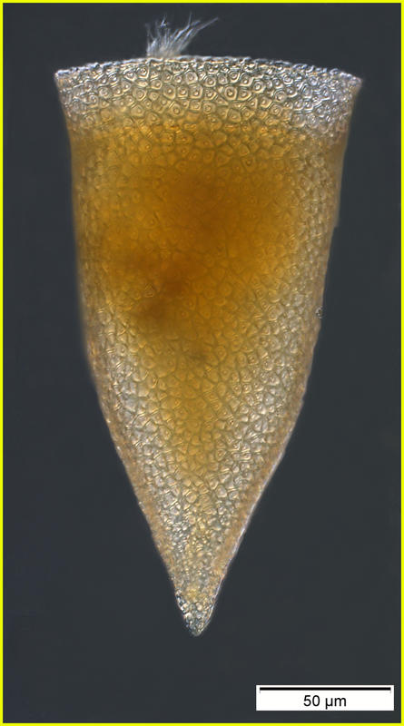 Cyttarocylis ampulla formerly known as Cyttarocylis casseis