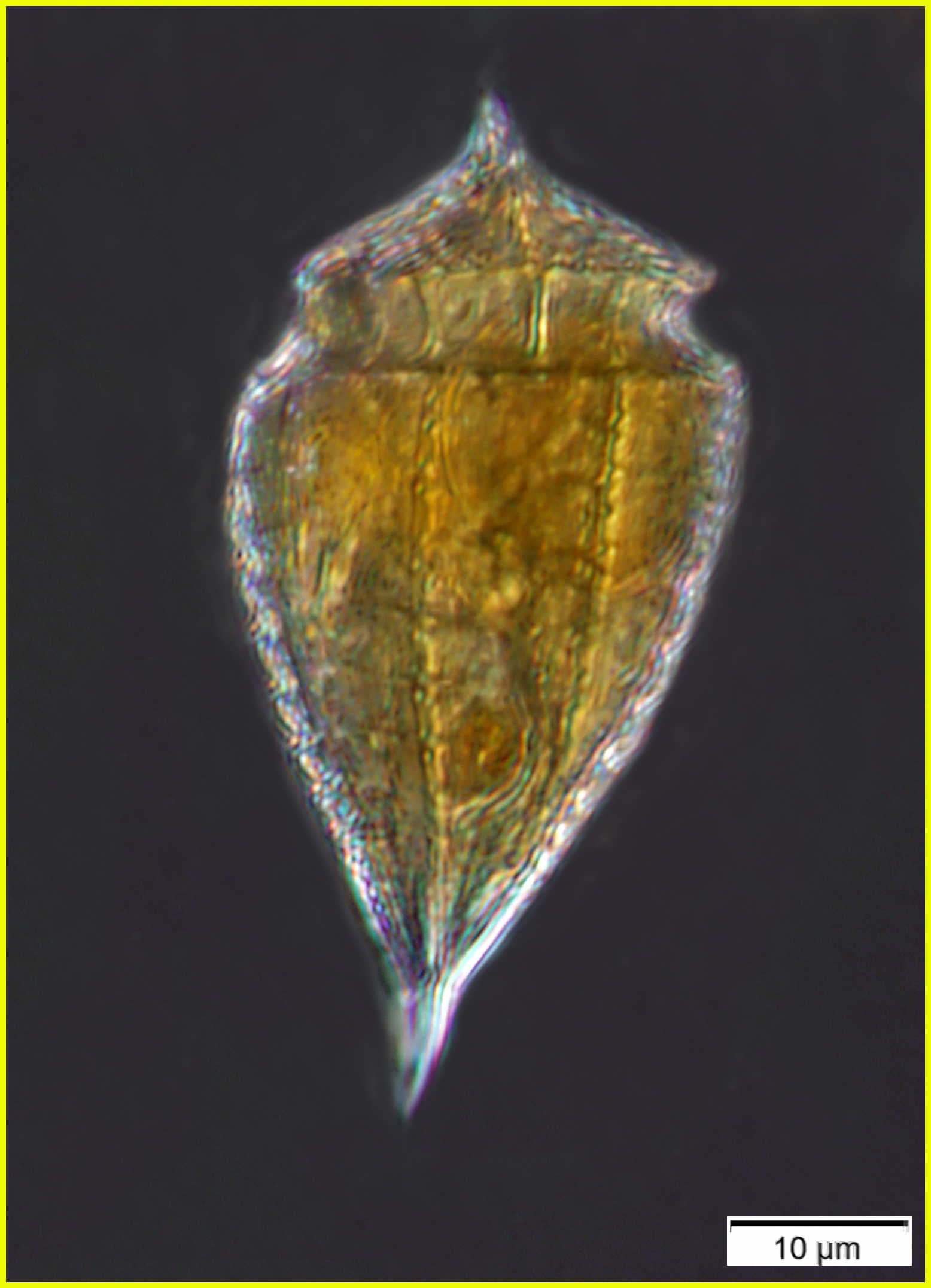 A small dinoflagellate from Station 64