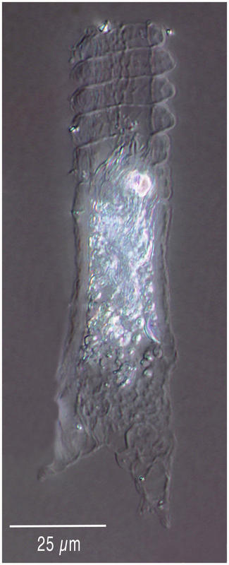 A small Climacocylis