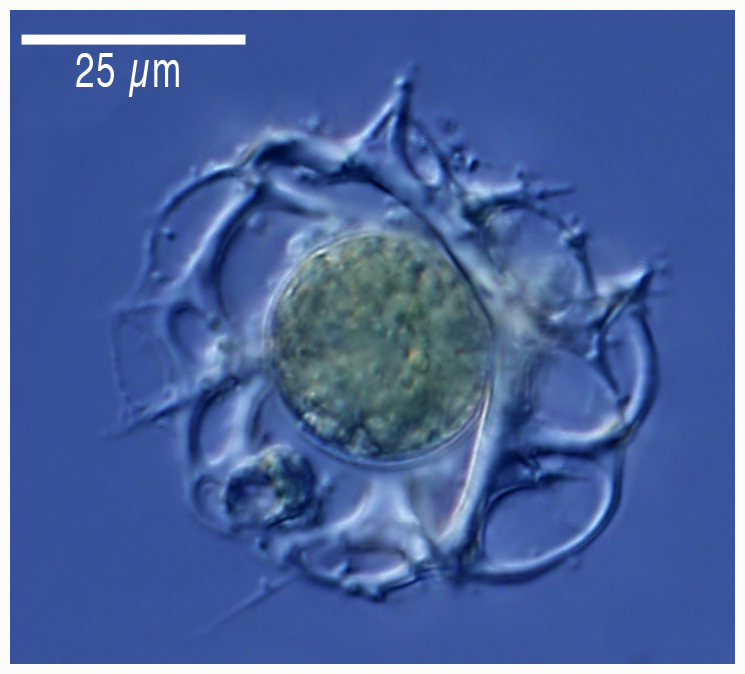 Peridium species (radiolarian)