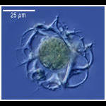 Peridium species (radiolarian)