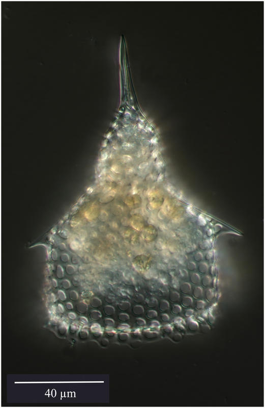 Pterocorys campanula Haeckel. [Pterocoryidae]