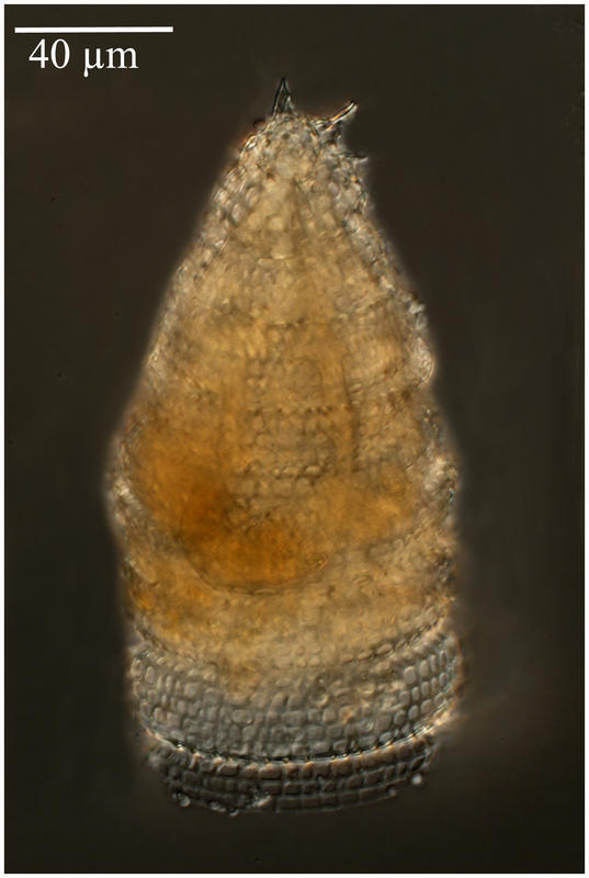 Spirocyrtis scalaris Haeckel. [Artostrobiidae] Formerly known as Spirocyrtis cornutella Haeckel