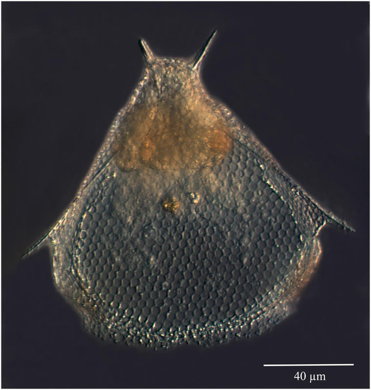 Trictenartus elegans (Haeckel) group [Triacartidae]