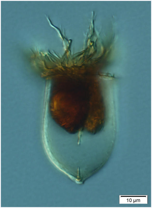 Acanthostomella novegica