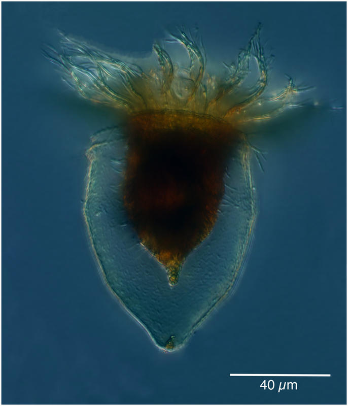 Ptychocylis obtusa from the Chukchi Sea