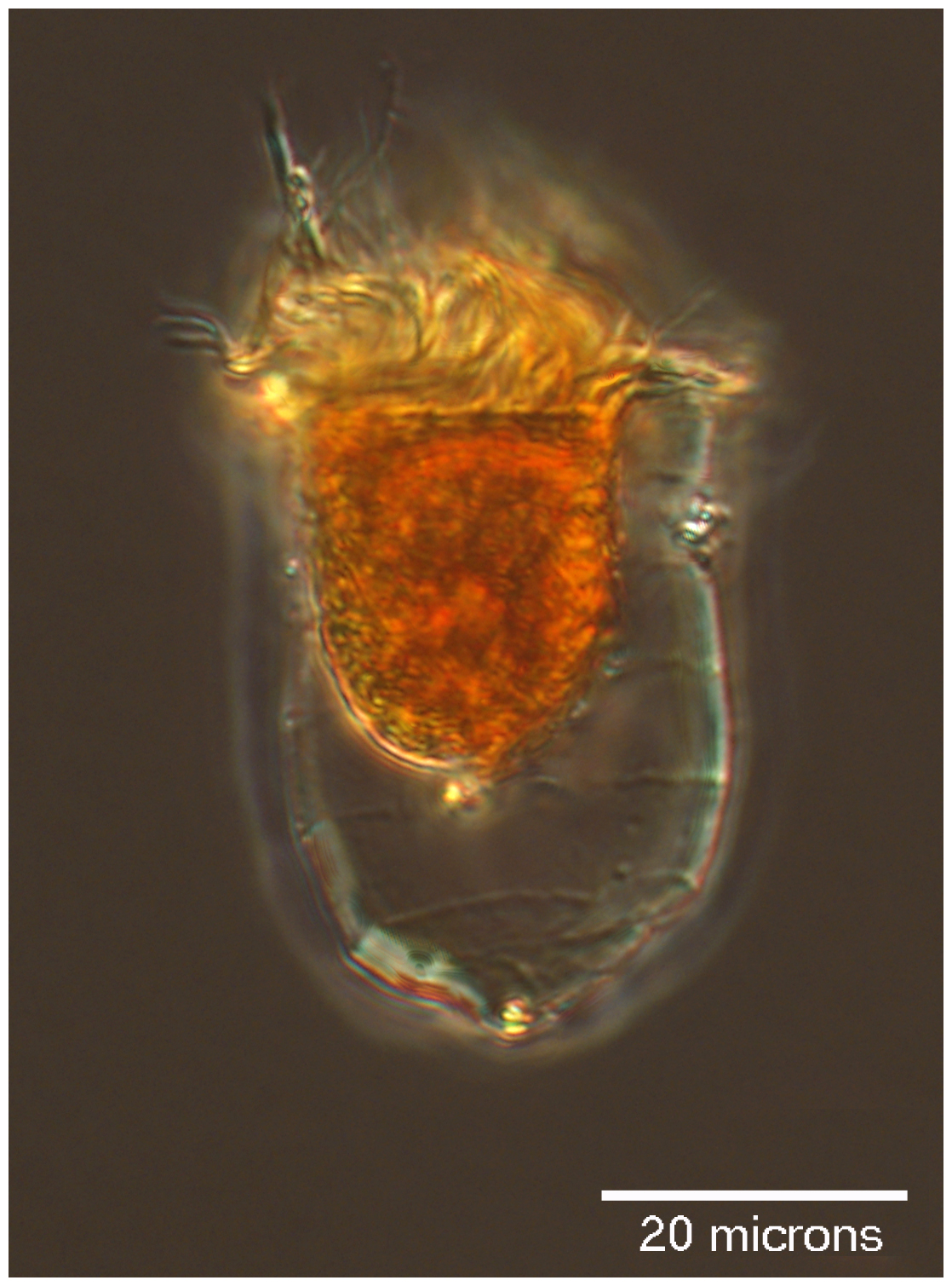 Acanthostomella norvegica 'coxiella form'