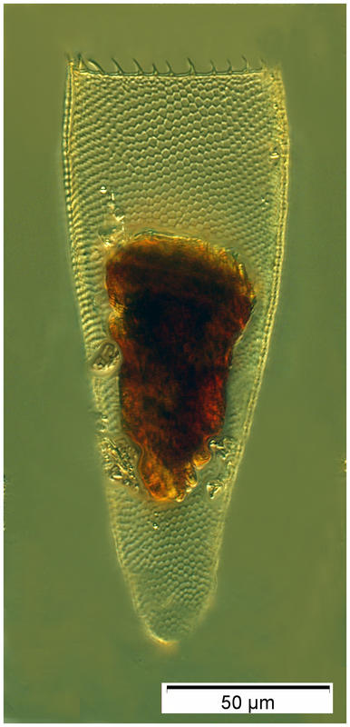 Parafavella hemifusus