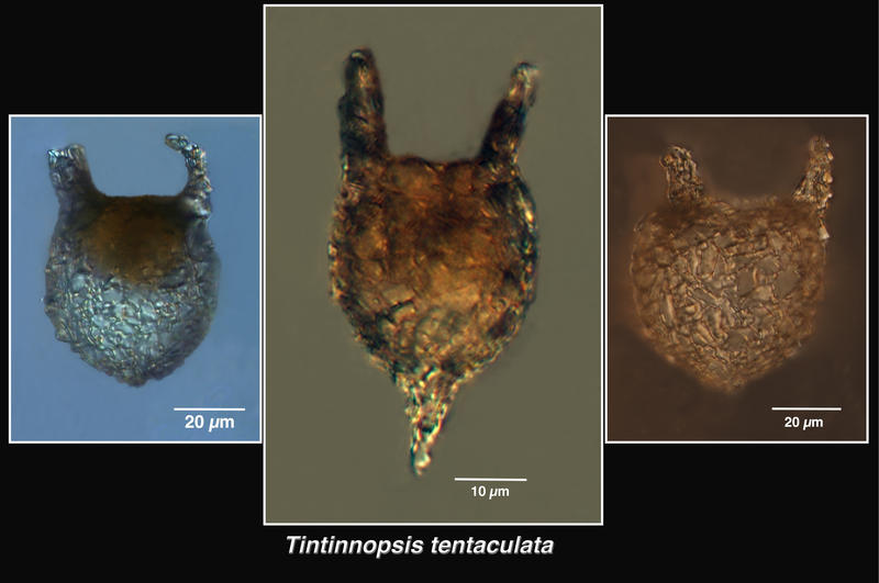 Tintinnopsis tentaculata