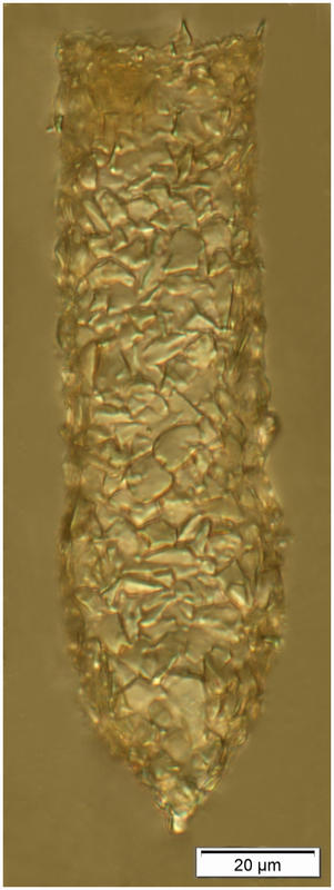 Tintinnopsis karajecensis