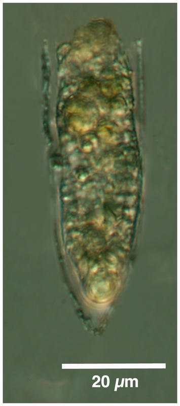 Helicostomella sp.