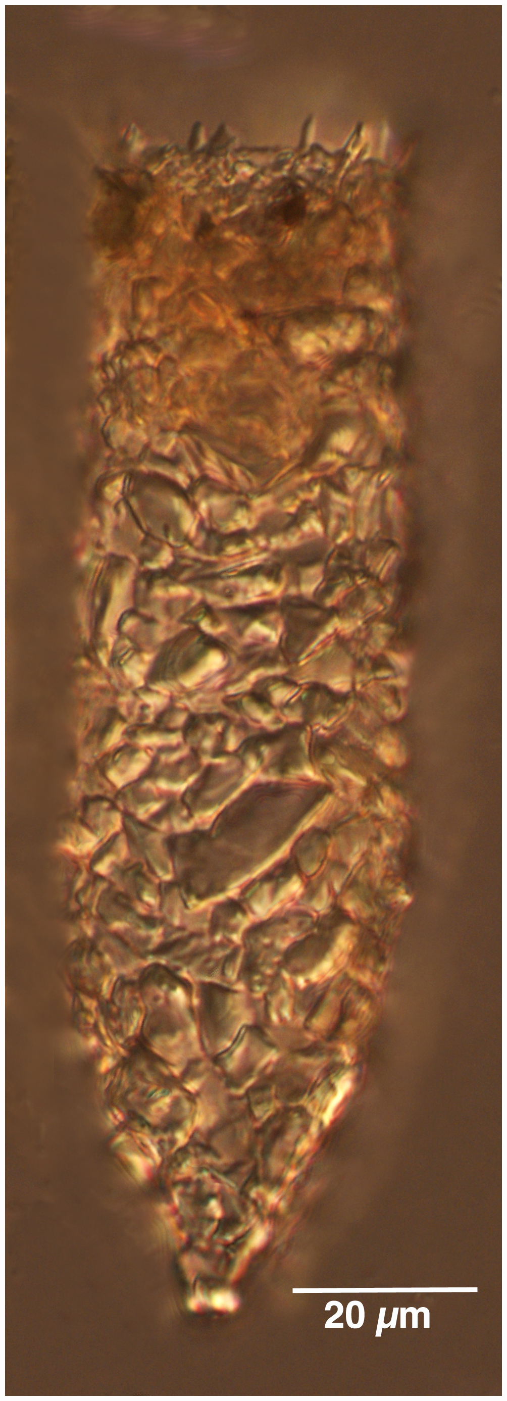Tintinnopsis cylindrica