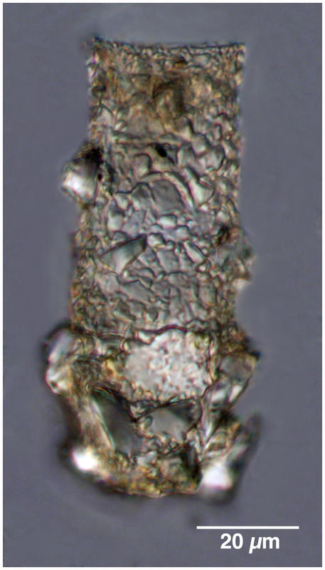 Codonellopsis schabi