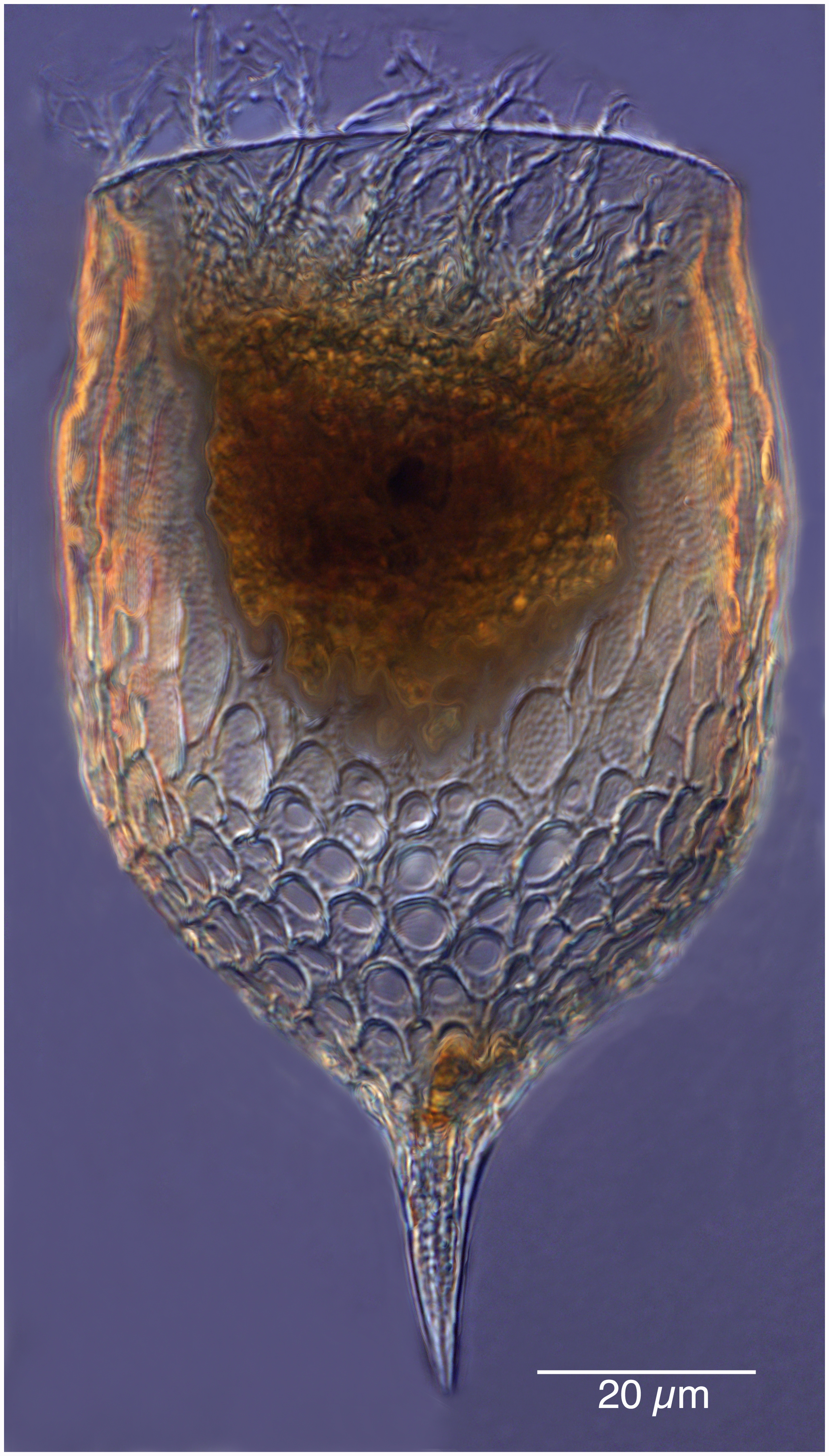 Epiplocylis undella