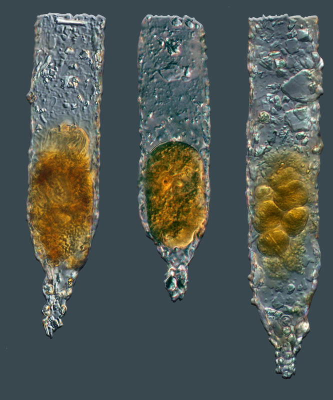 Tintinnopsis kofoidi - normal & parasitized